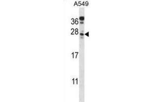 Western Blotting (WB) image for anti-Chromosome 4 Open Reading Frame 49 (C4orf49) antibody (ABIN2998187) (C4orf49 抗体)