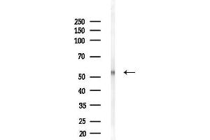anti-Solute Carrier Family 41, Member 1 (SLC41A1) antibody