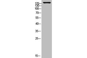 Western Blot analysis of customer's (cat sample) using Laminin γ-1 Polyclonal Antibody (Laminin gamma 1 抗体  (C-Term))