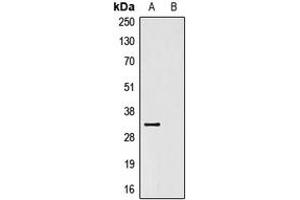 Western blot analysis of Anti-V5-tag Antibody against HEK293T cells transfected with vector overexpressing V5 tag (A) and untransfected (B).