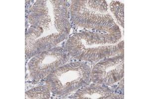 Immunohistochemical staining of human stomach with LRCH2 polyclonal antibody  shows cytoplasmic and membranous positivity in glandular cells. (LRCH2 抗体)