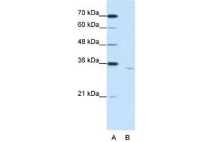 WB Suggested Anti-CPEB2 Antibody Titration:  1. (CPEB2 抗体  (Middle Region))