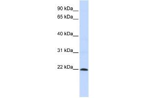 WB Suggested Anti-ZNF581 Antibody Titration:  0. (ZNF581 抗体  (N-Term))
