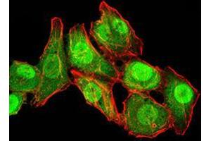 Immunocytochemistry (ICC) image for anti-RAN, Member RAS Oncogene Family (RAN) (AA 1-216) antibody (ABIN5876159) (RAN 抗体  (AA 1-216))