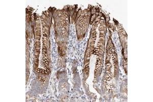 Immunohistochemical staining of human stomach with ZYG11A polyclonal antibody  shows strong cytoplasmic and membranous positivity in glandular cells at 1:50-1:200 dilution. (ZYG11A 抗体)