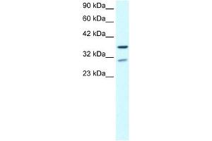 ZNF385 antibody used at 0. (ZNF385A 抗体  (N-Term))