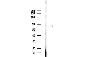 Western blot analysis of lysates from Mouse testis, using KLHL3 Antibody at 1/1000 dilution.