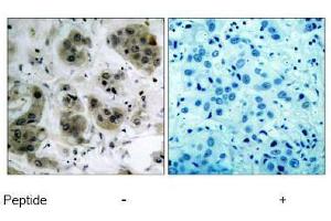 Image no. 1 for anti-V-Akt Murine Thymoma Viral Oncogene Homolog 1 (AKT1) (Ser473) antibody (ABIN197193) (AKT1 抗体  (Ser473))