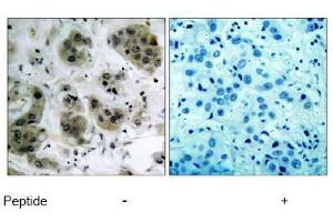 Image no. 1 for anti-V-Akt Murine Thymoma Viral Oncogene Homolog 1 (AKT1) (Ser473) antibody (ABIN197193) (AKT1 抗体  (Ser473))