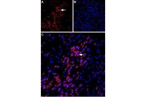 Expression of VPAC1 in rat amygdala - Immunohistochemical staining of immersion-fixed, free floating rat brain frozen sections using Anti-VPAC1 (VIPR1) (extracellular) Antibody (ABIN7043875, ABIN7045329 and ABIN7045330), (1:100). (VIPR1 抗体  (Extracellular))