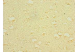 Immunohistochemistry (IHC) image for anti-Transient Receptor Potential Cation Channel, Subfamily C, Member 5 (TRPC5) (AA 764-973) antibody (ABIN7169531)