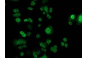 Anti-TP53 mouse monoclonal antibody (ABIN2454483) immunofluorescent staining of COS7 cells transiently transfected by pCMV6-ENTRY TP53 (RC200003). (p53 抗体)