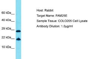 Host: Rabbit Target Name: FAM25E Sample Tissue: Human COLO205 Whole Cell Antibody Dilution: 1ug/ml (FAM25E 抗体  (C-Term))