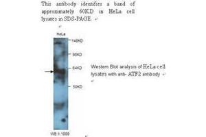 Image no. 1 for anti-Glial Cell Line Derived Neurotrophic Factor (GDNF) antibody (ABIN790851) (GDNF 抗体)