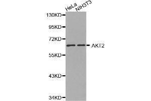 Western blot analysis of extracts of various cell lines, using AKT2 antibody. (AKT2 抗体)