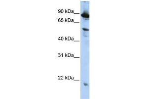 Western Blotting (WB) image for anti-Zinc Finger, CCCH-Type with G Patch Domain (ZGPAT) (N-Term) antibody (ABIN2775532)