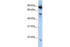 WB Suggested Anti-ZGPAT  Antibody Titration: 0.