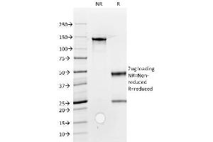 SDS-PAGE Analysis Purified ROR2 Mouse Monoclonal Antibody (ROR2/1912). (ROR2 抗体)
