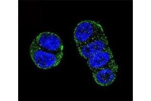 Confocal immunofluorescent analysis of PSMA antibody with ZR-75-1 cells followed by Alexa Fluor 488-conjugated goat anti-rabbit lgG (green). (PSMA 抗体  (AA 161-190))