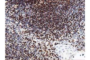 Image no. 1 for anti-Myocyte Enhancer Factor 2C (MEF2C) antibody (ABIN1499366) (MEF2C 抗体)