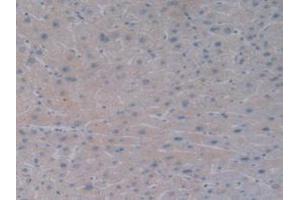 DAB staining on IHC-P; Samples: Human Liver Tissue. (BMP10 抗体  (AA 315-424))