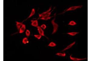 Immunofluorescence (fixed cells) (IF/ICC) image for anti-Prostaglandin D2 Receptor (PTGDR) (Internal Region) antibody (ABIN6259168)