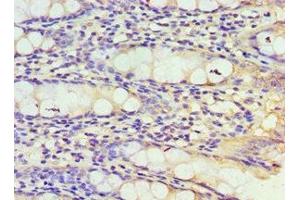 Immunohistochemistry of paraffin-embedded human colon tissue using ABIN7172045 at dilution of 1:100
