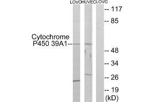 Western blot analysis of extracts from LOVO cells and HUVEC cells, using CYP39A1 antibody. (CYP39A1 抗体  (C-Term))