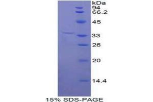 SDS-PAGE analysis of Human ENPP2 Protein. (ENPP2 蛋白)