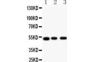 Anti-Muscarinic Acetylcholine Receptor 2 antibody, Western blotting All lanes: Anti Muscarinic Acetylcholine Receptor 2 () at 0. (Muscarinic Acetylcholine Receptor M2 抗体  (C-Term))