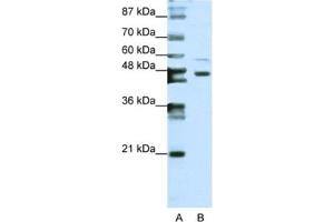 Western Blotting (WB) image for anti-Zinc Finger Protein 558 (ZNF558) antibody (ABIN2461973) (ZNF558 抗体)