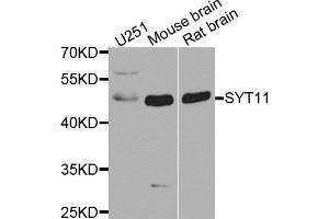 Western blot analysis of extract of various cells, using SYT11 antibody. (SYT11 抗体)