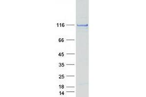 Validation with Western Blot (CC2D1A Protein (Myc-DYKDDDDK Tag))