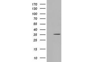 Western Blotting (WB) image for anti-Short Chain Dehydrogenase/reductase Family 9C, Member 7 (SDR9C7) antibody (ABIN1500840) (SDR9C7 抗体)