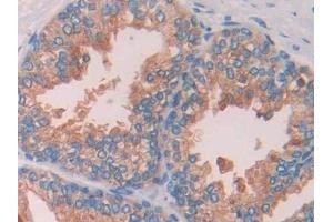 Detection of CBG in Human Prostate Tissue using Polyclonal Antibody to Corticosteroid Binding Globulin (CBG) (SERPINA6 抗体  (AA 218-378))