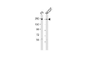 All lanes : Anti-PBRM1 Antibody (C-term) at 1:2000 dilution Lane 1: F9 whole cell lysates Lane 2: NCCIT whole cell lysates Lysates/proteins at 20 μg per lane. (Polybromo 1 抗体  (C-Term))