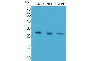 Western Blotting (WB) image for anti-Breast Cancer Metastasis-Suppressor 1-Like (BRMS1L) (C-Term) antibody (ABIN3178189) (BRMS1L 抗体  (C-Term))