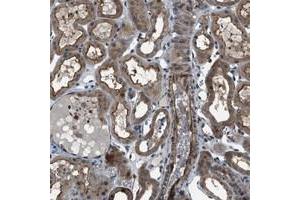 Immunohistochemical staining of human kidney with TMEM132C polyclonal antibody  shows cytoplasmic and membranous positivity in renal tubules.
