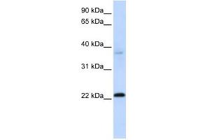 C11ORF74 antibody used at 1 ug/ml to detect target protein. (C11ORF74 抗体  (Middle Region))