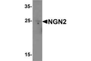 Western blot analysis of NGN2 in rat brain tissue lysate with NGN2 Antibody  at 1 μg/mL (Neurogenin 2 抗体  (C-Term))