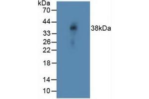 Western blot analysis of Rat Vein Tissue. (NOTCH4 抗体  (AA 1715-2001))