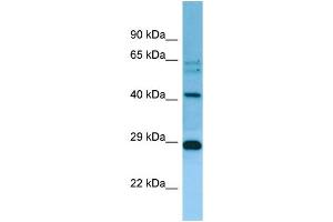 WB Suggested Anti-MRPL38 Antibody Titration: 1. (MRPL38 抗体  (C-Term))