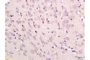 Formalin-fixed and paraffin embedded rat brain labeled with Anti-Tubulin-beta Polyclonal Antibody, Unconjugated (ABIN726320) at 1:200 followed by conjugation to the secondary antibody and DAB staining