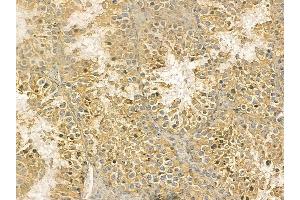 TUBA4A Mouse Monoclonal Antibody at 1/100 staining mouse testis tissue by IHC-P. (TUBA4A 抗体)