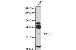 Western blot analysis of extracts of A-549 cells, using SPRTN antibody (ABIN6131456, ABIN6148389, ABIN6148391 and ABIN6215355) at 1:3000 dilution. (Spartan 抗体  (AA 1-240))