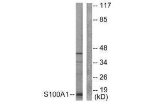 Western blot analysis of extracts from A549 cells, using S100 A1 antibody. (S100A1 抗体)