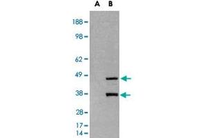 HEK293 overexpressing SIRT3 and probed with SIRT3 polyclonal antibody  (mock transfection in first lane), tested by Origene. (SIRT3 抗体)