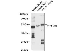 Western blot analysis of extracts of various cell lines, using RBM45 antibody (ABIN6128634, ABIN6146784, ABIN6146785 and ABIN6217980) at 1:3000 dilution. (RBM45 抗体  (AA 1-300))
