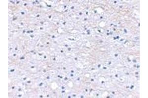 Immunohistochemical staining of human brain tissue using AP30163PU-N BRAL1 antibody at 2. (HAPLN2 抗体  (Center))