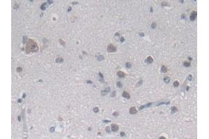 Immunohistochemistry (IHC) image for anti-Methylenetetrahydrofolate Reductase (NAD(P)H) (MTHFR) (AA 1-325) antibody (ABIN7436504)